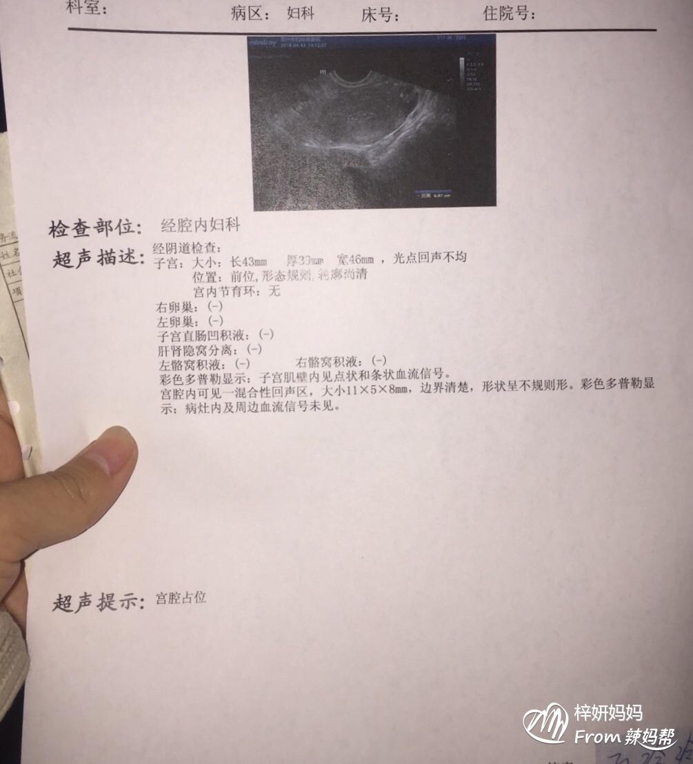 人流检测仪_der2571土壤电阻仪检测_苯检测泄漏仪